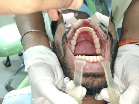 Orthomania orthodontic training for general dentists, Chembur Mumbai, photo 137